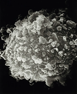SEM of whole T-cell infected with HIV SEM of whole T-cell infected with HIV