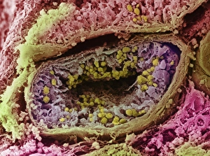 Seminiferous tubule of testis Seminiferous tubule of testis