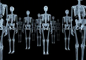 Human Body Prints: Frontal view X-ray print of a group of skeletons