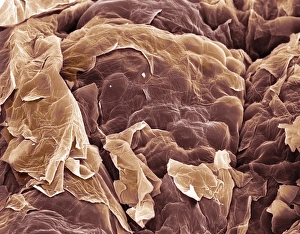 Epithelial Cell Structure Prints: Skin, SEM