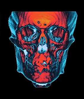 Human Skull Anatomy Prints: Skull, CT scan