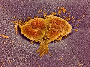 Small intestine lining print, SEM micrograph