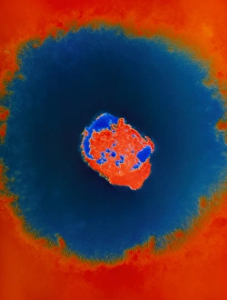 Smallpox virus Smallpox virus