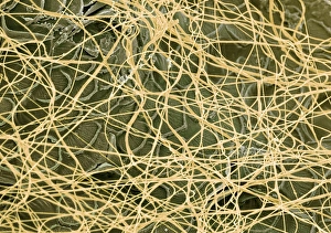Prints of Spiders web. Coloured scanning electron micrograph (SEM) of threads of spiders silk (yellow) encasing a woodlouse. Silk is produced from silk glands in the abdomen of the spider Images Dated 2003 October: SEM Print of a Spider's Web with Encased Woodlouse
