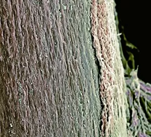Images Dated 2nd January 2003: Spinal cord, SEM