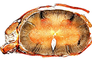 Spinal Cord Anatomy Prints: Spinal cord, transverse section