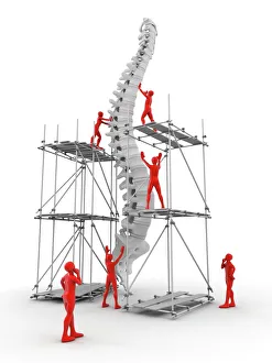 Spine with workers, spine repair F007/9907 Spine with workers, spine repair F007/9907