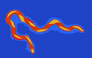 Spirochaete bacterium, Treponema Spirochaete bacterium, Treponema