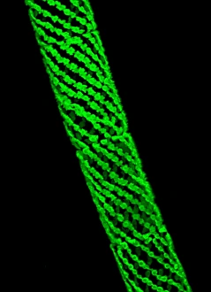 Confocal Microscopy Images Prints: Spirogyra algae