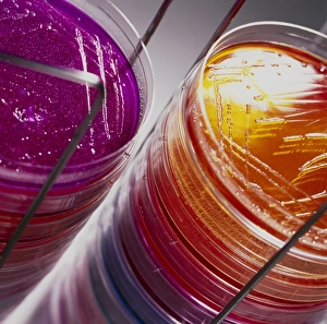 Stack of petri dishes with bacterial cultures Stack of petri dishes with bacterial cultures
