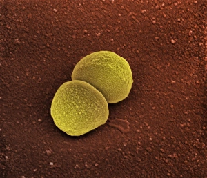 SEM Images Of Bacteria Prints: Staphylococcus aureus bacteria, SEM C013 / 4770