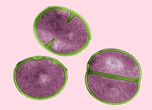 Staphylococcus Aureus Prints: Staphylococcus aureus dividing, TEM