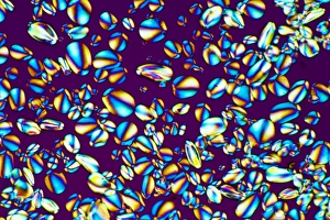 Polarised Light Microscopy Prints: Starch grains, light micrograph