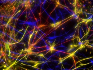 Stem cell-derived nerve cells Print