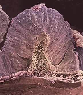 Stomach wall, SEM Stomach wall, SEM