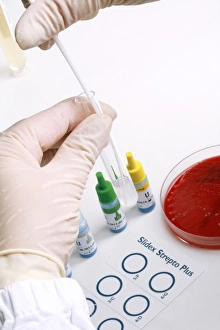Streptococcus Grouping Test Print