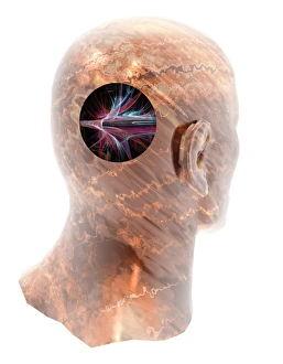 Prints of Stroke. Conceptual computer artwork of a stroke, showing a cut-away of a human head and a blood vessel bursting in the brain. A stroke is also known as a cerebrovascular accident (CVA) Images Dated 2008 December: Human Head with Bursting Blood Vessel Print