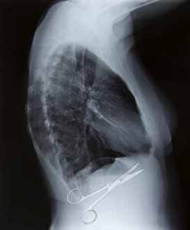 Prints of Surgical errors, conceptual image Images Dated 2012 November: Surgical Error Print