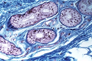 Sweat gland in skin Sweat gland in skin