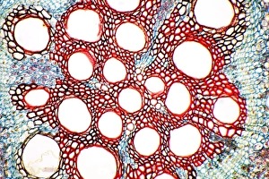 Light Micrograph Prints: Sweet potato root, light micrograph