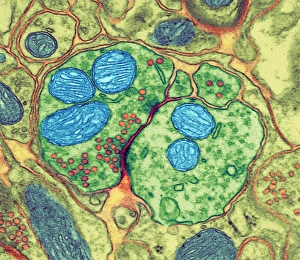 TEM Print of Synaptic Junction Structure