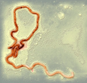 Transmission Electron Micrograph TEM Prints: Syphilis bacterium, TEM