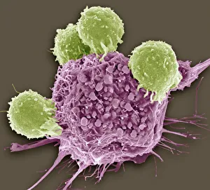 T lymphocytes and cancer cell, SEM C001/1679 T lymphocytes and cancer cell, SEM C001/1679