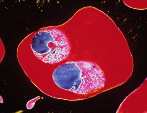 TEM of 2 merozites of the malaria parasite TEM of 2 merozites of the malaria parasite