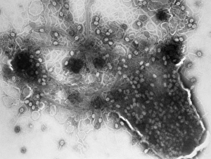 TEM of bacterial lysis due to T4 phage infection TEM of bacterial lysis due to T4 phage infection