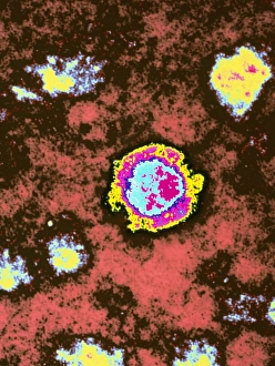 TEM of a Borna disease virus, cause of depression TEM of a Borna disease virus, cause of depression