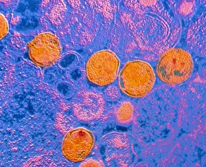 TEM of Chlamydia sp. spherical bacteria TEM of Chlamydia sp. spherical bacteria