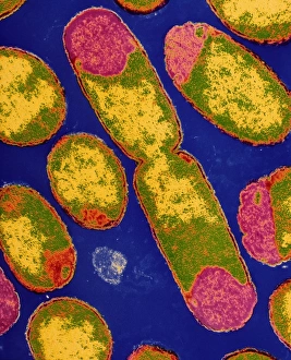 Escherichia Coli Micrograph Prints: TEM of dividing E. coli bacterium