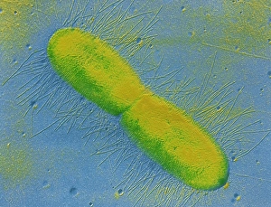 Transmission Electron Microscopy Images Prints: TEM of E. coli bacterium