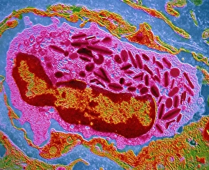 TEM of eosinophil, type of white blood cell TEM of eosinophil, type of white blood cell