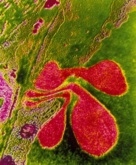 TEM of erythrocytes passing through capillary wall TEM of erythrocytes passing through capillary wall