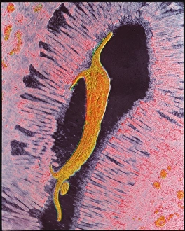 TEM of Giardia lamblia TEM of Giardia lamblia