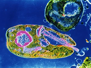 TEM of Leishmania sp TEM of Leishmania sp