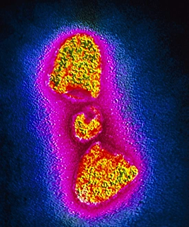 TEM of a rabies virus particle TEM of a rabies virus particle