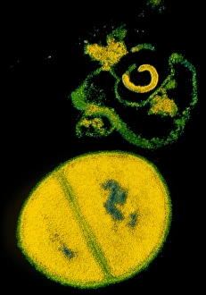 TEM Staphylococcus aureus TEM Staphylococcus aureus