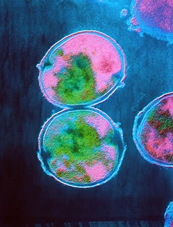 TEM of Streptococcus pneumoniae bacteria TEM of Streptococcus pneumoniae bacteria