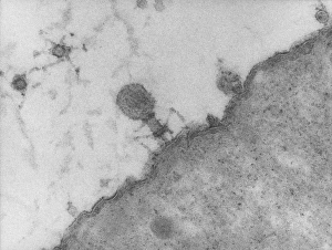 TEM of T4 bacteriophage infecting E. coli TEM of T4 bacteriophage infecting E. coli