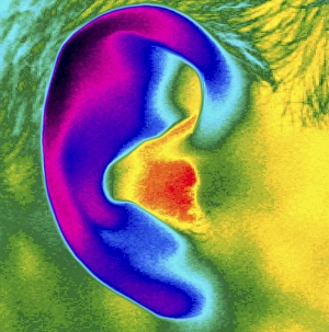 Thermogram of a close-up of a human ear Thermogram of a close-up of a human ear
