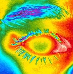 Thermogram of a close-up of a human eye Thermogram of a close-up of a human eye