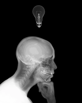 Xray Prints: X-ray Image of a Thinking Man with a Lightbulb Print