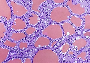 Thyroid gland, light micrograph Thyroid gland, light micrograph