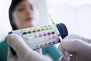 Urine analysis Urine analysis