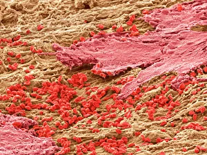 SEM Prints: SEM Print of Uterus Lining during Menstruation