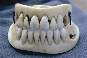 Prints of Waterloo false teeth. These Victorian dentures were made from real teeth embedded in ivory (across top and bottom) Images Dated 2003 November: Waterloo Teeth Print: Ivory dentures with embedded human teeth