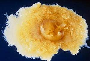 Six week old embryo together with the chorion Six week old embryo together with the chorion