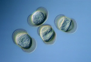 Winged pollen grains from Lebanon cedar Winged pollen grains from Lebanon cedar
